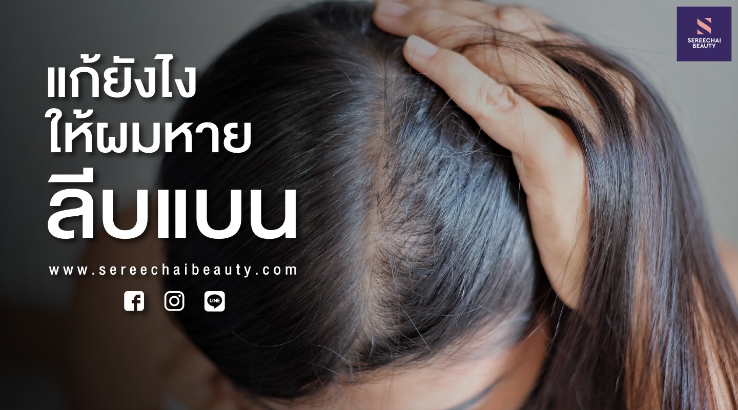 แก้ยังไงให้ผมหายลีบแบน